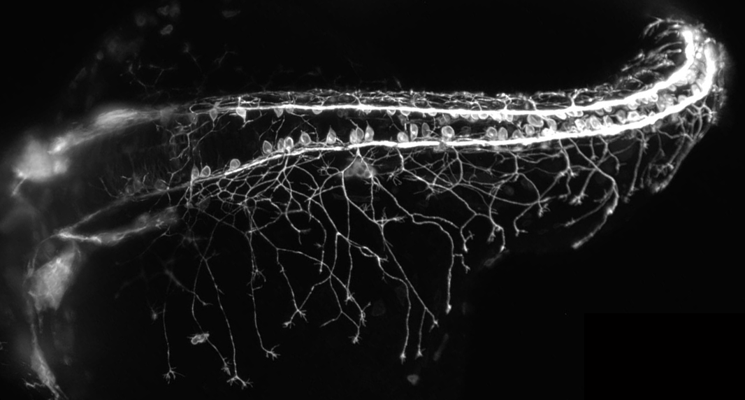 A black and white microscopy image of a neuronal network that looks like a tunnel with lots of thin string-like branches extending below it.