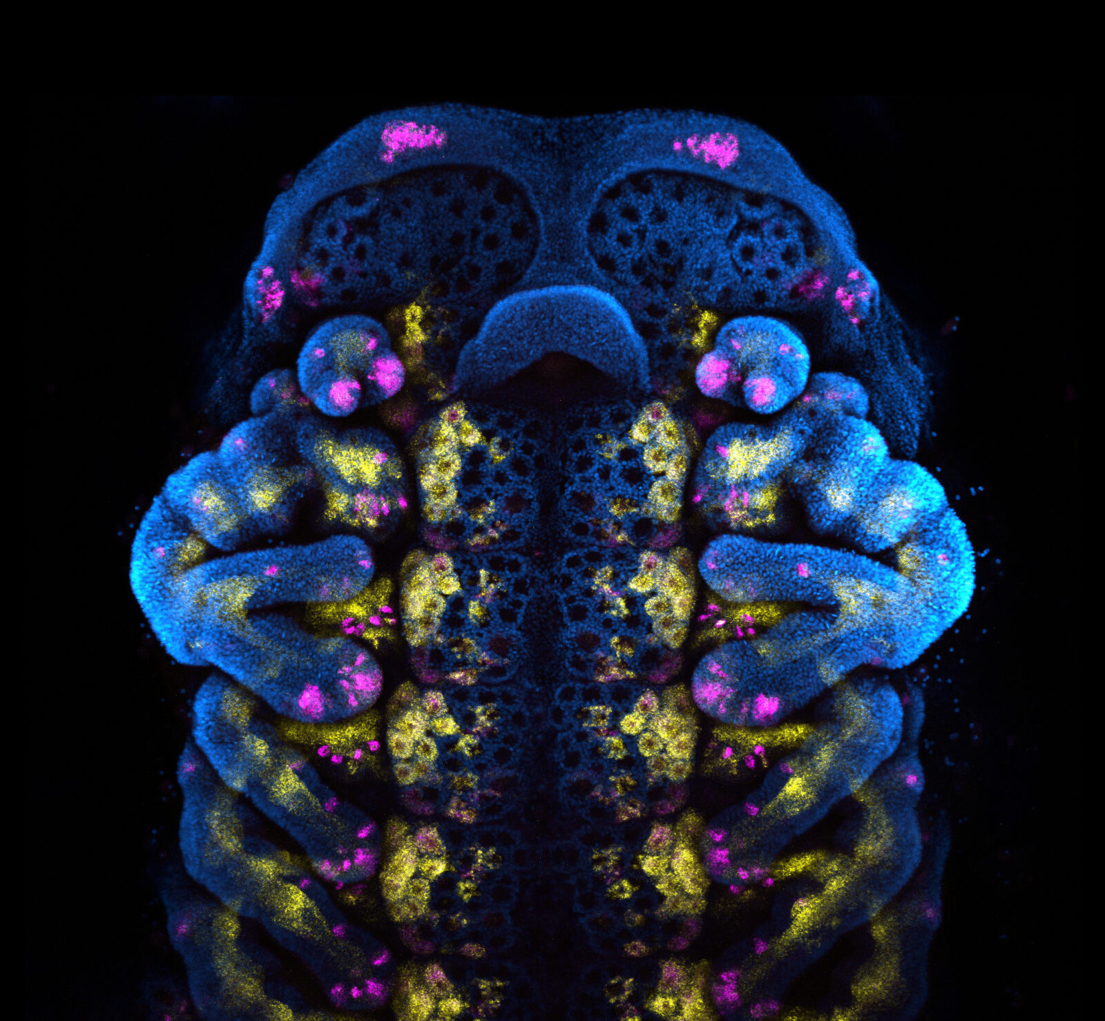 A microscopy image of a scorpion embryo with certain genetic markers fluoresced in pink and yellow.