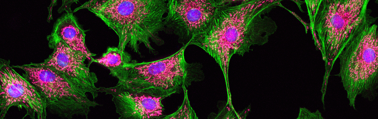 A microscopic image of a collection of connected cells where the outside edges of the cells are a bright green and the inside are bright pink and purple.