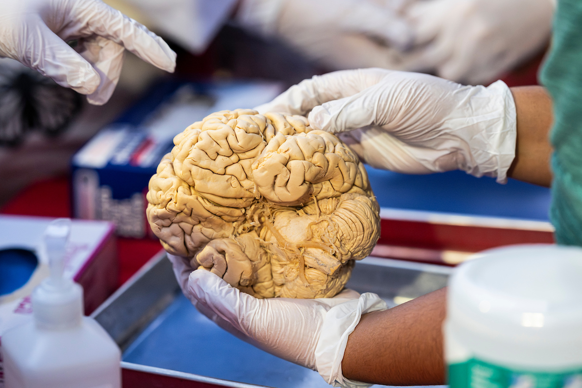 Gloved hands examine a preserved human brain.