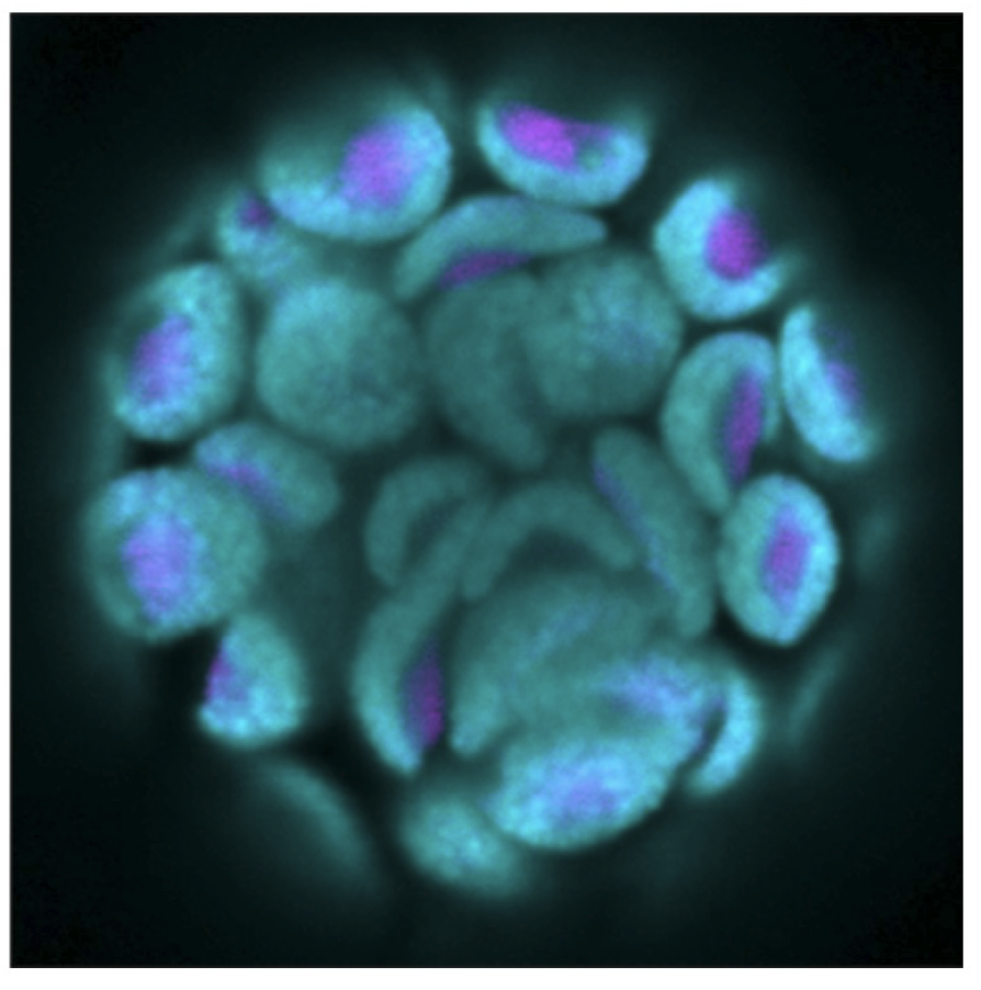A microscopy image of a plant cell with a particular protein marked by purple.